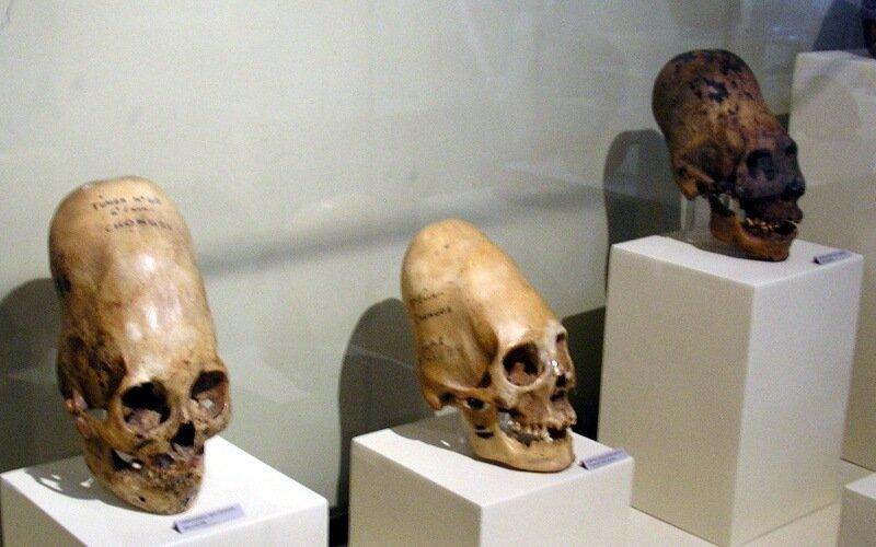 Elongated skulls